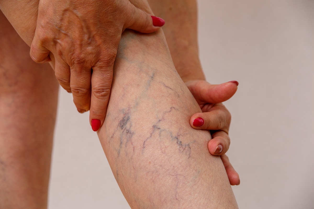 elderly-woman-white-panties-shows-cellulite-varicose-veins-light-isolated-background.jpg